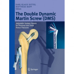 The Double Dynamic Martin Screw (DMS): Adjustable Implant System for Proximal and Distal Femur Fractures