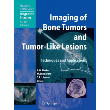Imaging of Bone Tumors and Tumor-Like Lesions: Techniques and Applications