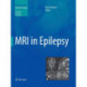 MRI in Epilepsy