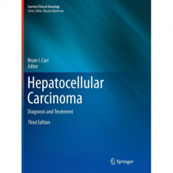 Hepatocellular Carcinoma: Diagnosis and Treatment