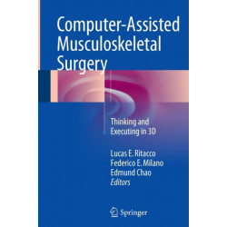 Computer-Assisted Musculoskeletal Surgery: Thinking and Executing in 3D