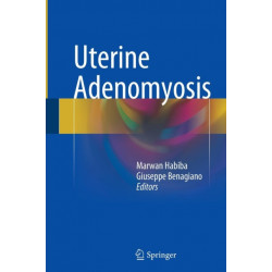 Uterine Adenomyosis