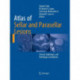 Atlas of Sellar and Parasellar Lesions: Clinical, Radiologic, and Pathologic Correlations