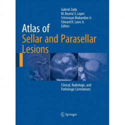 Atlas of Sellar and Parasellar Lesions: Clinical, Radiologic, and Pathologic Correlations