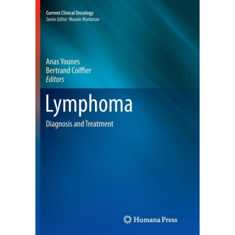 Lymphoma: Diagnosis and Treatment