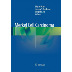 Merkel Cell Carcinoma
