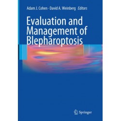 Evaluation and Management of Blepharoptosis