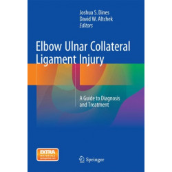 Elbow Ulnar Collateral Ligament Injury: A Guide to Diagnosis and Treatment