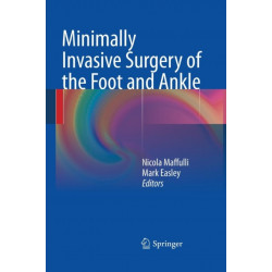 Minimally Invasive Surgery of the Foot and Ankle