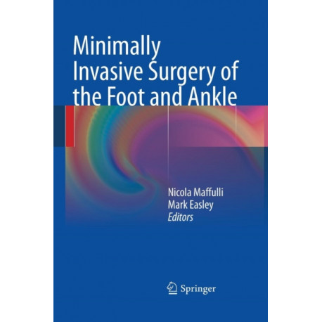 Minimally Invasive Surgery of the Foot and Ankle