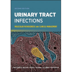 Urinary Tract Infections: Molecular Pathogenesis and Clinical Management