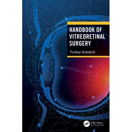Handbook of Vitreoretinal Surgery