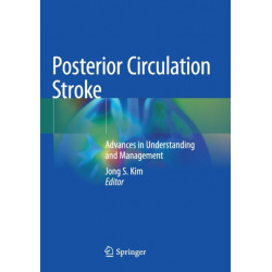 Posterior Circulation Stroke: Advances in Understanding and Management