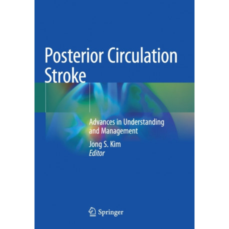 Posterior Circulation Stroke: Advances in Understanding and Management