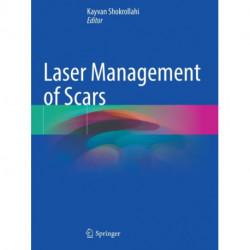 Laser Management of Scars