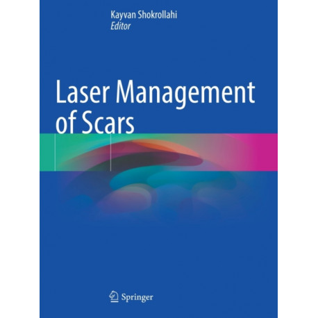 Laser Management of Scars