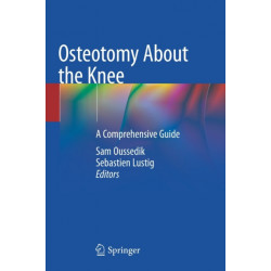 Osteotomy About the Knee: A Comprehensive Guide