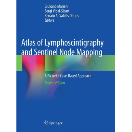Atlas of Lymphoscintigraphy and Sentinel Node Mapping: A Pictorial Case-Based Approach