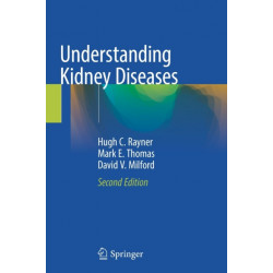 Understanding Kidney Diseases