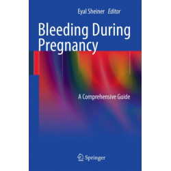 Bleeding During Pregnancy: A Comprehensive Guide