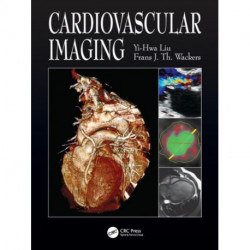 Cardiovascular Imaging