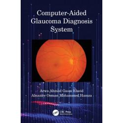 Computer-Aided Glaucoma Diagnosis System