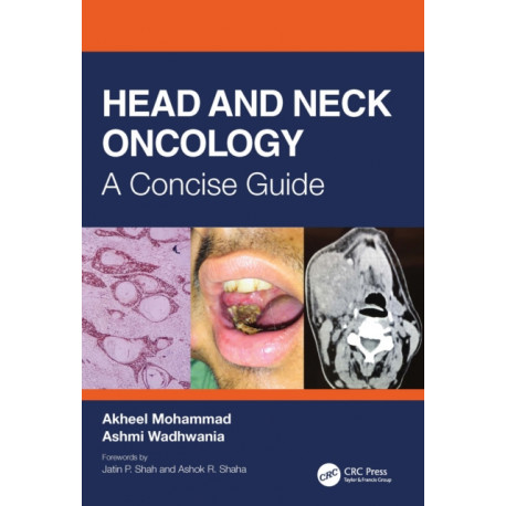 Head and Neck Oncology: A Concise Guide