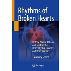 Rhythms of Broken Hearts: History, Manifestations, and Treatment of Heart Rhythm Disorders and Heart Disease