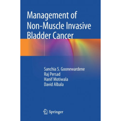 Management of Non-Muscle Invasive Bladder Cancer
