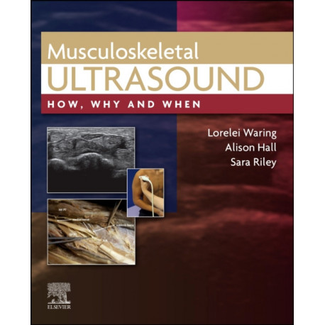 Musculoskeletal Ultrasound: How, Why and When