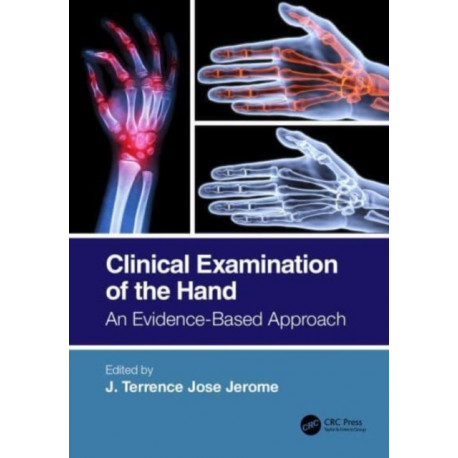 Clinical Examination of the Hand: An Evidence-Based Approach