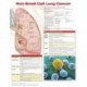Non-Small Cell Lung Cancer, Chart Laminated