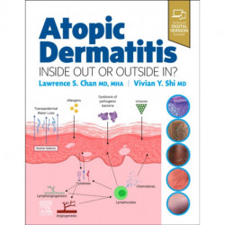 Atopic Dermatitis: Inside Out or Outside In