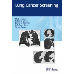 Lung Cancer Screening