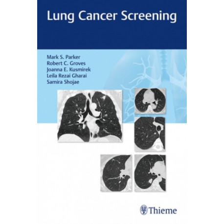 Lung Cancer Screening