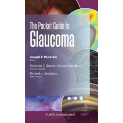 The Pocket Guide to Glaucoma
