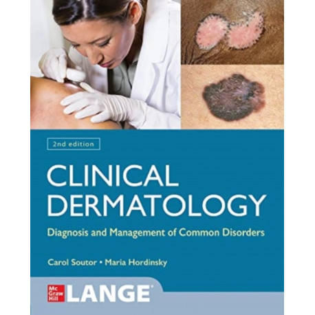 Clinical Dermatology: Diagnosis and Management of Common Disorders, Second Edition