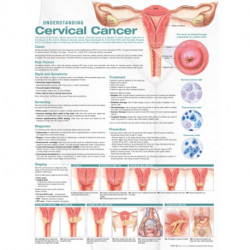Understanding Cervical Cancer Anatomical Chart