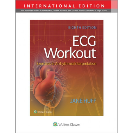 ECG Workout: Exercises in Arrythmia Interpretation