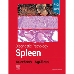 Diagnostic Pathology: Spleen