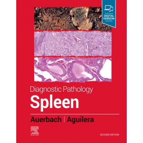 Diagnostic Pathology: Spleen
