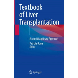 Textbook of Liver Transplantation: A Multidisciplinary Approach