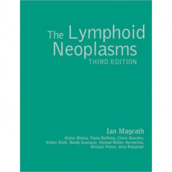 The Lymphoid Neoplasms 3ed