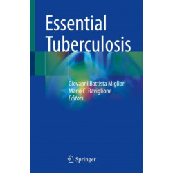 Essential Tuberculosis