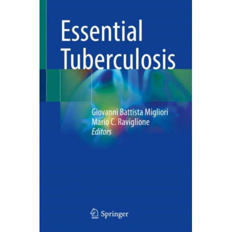 Essential Tuberculosis
