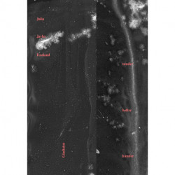 tænder hofter hænder