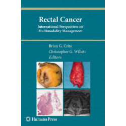 Rectal Cancer: International Perspectives on Multimodality Management