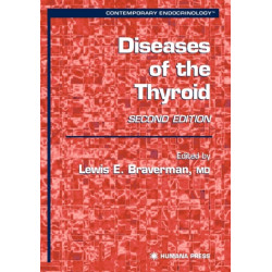 Diseases of the Thyroid