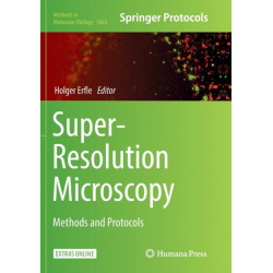 Super-Resolution Microscopy: Methods and Protocols