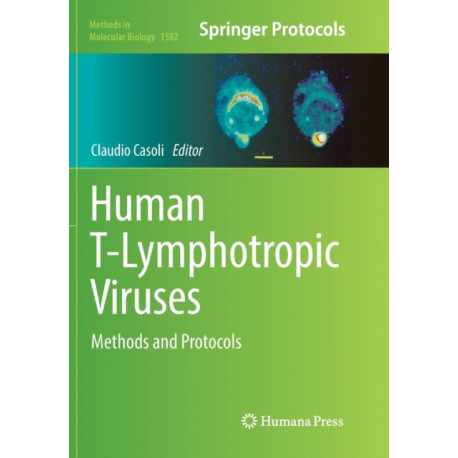 Human T-Lymphotropic Viruses: Methods and Protocols